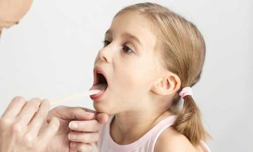 Чем лучше полоскать горло ребенку 6 лет при ангине