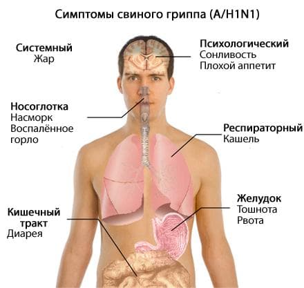 simptomy-grippa