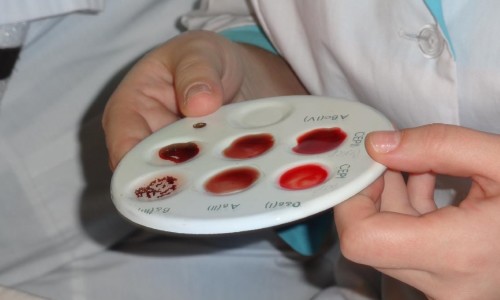 Сдача анализа для определения группы крови