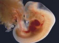 Как выглядит эмбрион в 5 недель