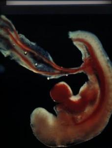 Фото эмбриона на 4 неделе беременности