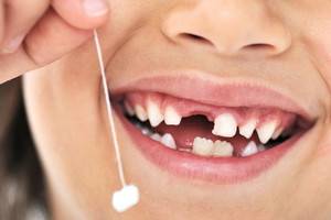 смена молочных зубов на коренные