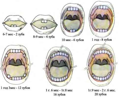 сроки прорезывания молочных зубов