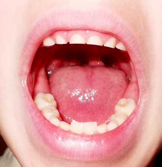 смена зубов Сколько зубов у ребенка