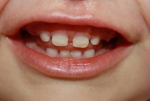 сколько зубов должно быть в год
