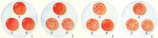 Система групп крови