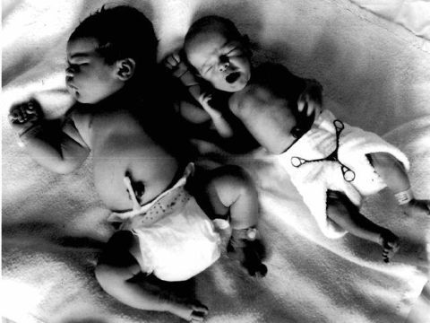 Самые крупные младенцы, из когда-либо родившихся (12 фото)
