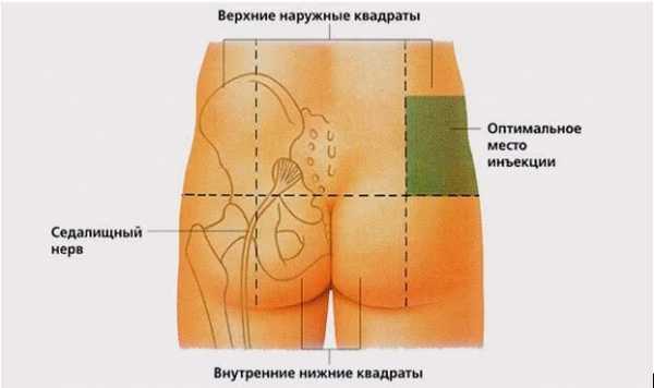 Тройчатка от температуры для ребенка 5 лет